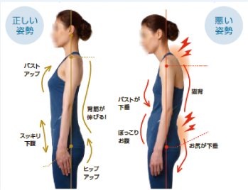 良い姿勢と悪い姿勢の比較